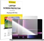 Techsuit MacBook Air 13" 2025 Clear Techsuit VisionProX Anti-Blue Light