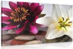 Dovido Tablou flori în castron cu pietre Zen - 60x40