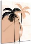 Dovido Tablou forme abstracte botanice de palmier - 80x120