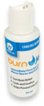 PATELLA Burn Jel gél égésre 50 ml - doktorpatika