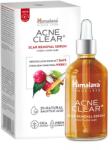 Himalaya Acne Clear pattanások utáni hegeltávolító szérum - 30ml ( Kiszerelés: 30ml )