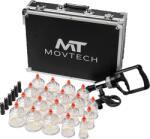 MovTech Cuppsett - 19 db-os köpölyöző szett