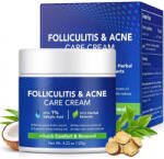 NOVA KISS Crema pentru Iritatii Piele sau Scalp, Anti-Acnee si Cosuri, Formula Premium, 120g