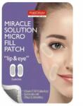 Purederm Plasturi cu acid hialuronic pentru fata Micro Fill Patch 2buc (PD658) Masca de fata
