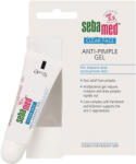 sebamed Gel pentru tratamentul topic al acneei Clear Face (Anti Pimple Gel) 10 ml - vivantis
