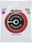 Martin MA535T Custom Light 92/8 Phospor Bronze 11-52