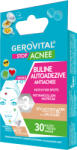Gerovital Buline autoadezive antiacnee Gerovital Stop Acnee, 30 buc (5943000105687)