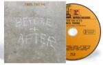 Warner Young Neil: Before And After - Blu-ray (068235)