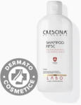Labo Suisse Sampon pentru barbati Transdermic HFSC Crescina, 500ml, Labo