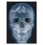 SteelPoster Fém poszter xray mountains Tábla Tepsi 42 x 59, 4 cm +ajándék (plakat dekoracyjny, metalowa tablica, szyld)