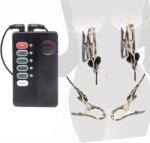 SuperLove E-Stim Nipple Clamps & Labia Set