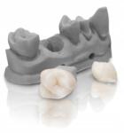  Bego VarseoSmile Crown plus 3D nyomtató gyanta Bl 0, 5 kg