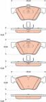 TRW Set Placute Frana, Frana Disc Gdb1815 Mercedes-Benz E-Class/E-Class T-Model (GDB1815)
