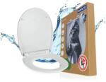 WENKO Relief wc ülőke lecsapodás-gátlós fehér-fekete 26505100 (26505100)