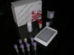  ScheBo Pancreas Elastase 1 ELISA Kit (szérumból) (SUN130)