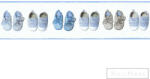 AS Creation kék kis cipők bordűr 35864-2 (35864-2)