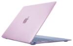 XPRO MacBook Pro 15 Retina - Pink