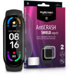 MyScreen Xiaomi Mi Smart Band 5/Mi Smart Band 6 ütésálló képernyővédő fólia - MyScreen Protector AntiCrash Shield Edge3D - 2 db/csomag - átlátszó