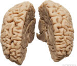 Erler Zimmer Emberi agy (női), élethű reprodukció (MO-C715)