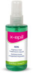  X-Epil SOS - szőrbenövést megelőző folyadék (75ml)