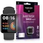 Myscreenprotector MSP LA-2165 Xiaomi Redmi Watch 2 Lite AntiCrash Shield Edge3D 2db ütésálló képernyővédő fólia (LA-2165) - bestbyte